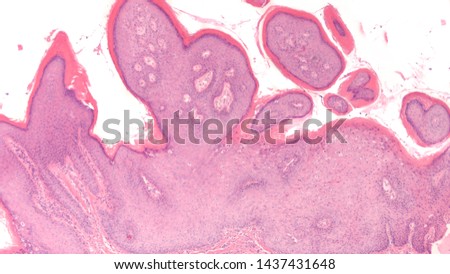 színes giardia kakil papillomavírus cin 3