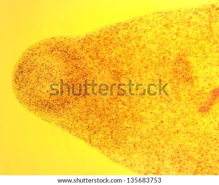 Lancet liver fluke (Dicrocoelium dendriticum) - permanent slide plate under high magnification