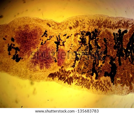 Lancet liver fluke (Dicrocoelium dendriticum) - permanent slide plate under high magnification