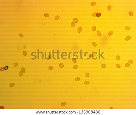 Lancet liver fluke eggs (Dicrocoelium dendriticum) - permanent slide plate under high magnification