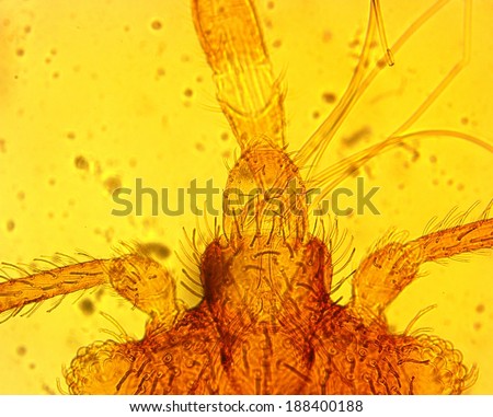 Common bed bug (Cimex lectularius) mouthparts - permanent slide plate under high magnification