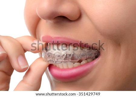 A woman putting a mouthguard