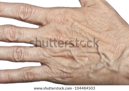 wrinkled woman skin on hand