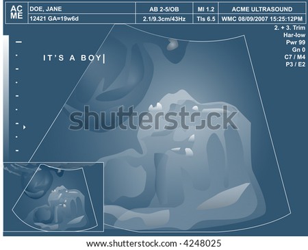 It\'s a boy! Rendered illustration of blue-tinged ultrasound with the words \