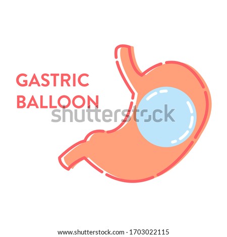 Gastric balloon non surgical weight loss procedure in stomach. Medical concept. Human body organ anatomy and health care. Vector illustration in flat style.