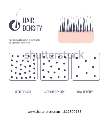 Hair density types classification set. Low, medium, high hair volume on scalp. Anatomical strand structure linear scheme. Outline vector illustration. 