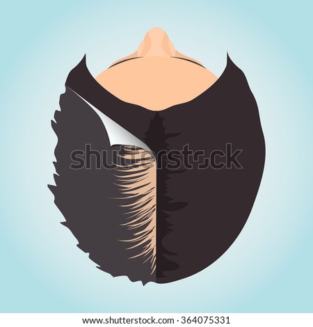 Top view of a balding woman before and after hair treatment. Divided image of the head. Two halves. Sticker revealing healthy scalp. Female alopecia. Isolated vector illustration.