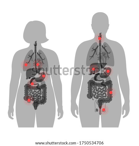 Set with flat vector isolated illustration of pain and inflammation in adult male and female obese body. Digestive system anatomy. Lung, liver, heart and other internal organs icon. Poster for clinic