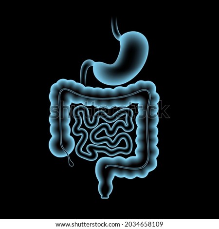 Colon and stomach anatomical poster. Small and large intestine in human body. Gastrointestinal disease, medical exam in gastroenterology. Digestive tract, medical scan of bowel 3D vector illustration.