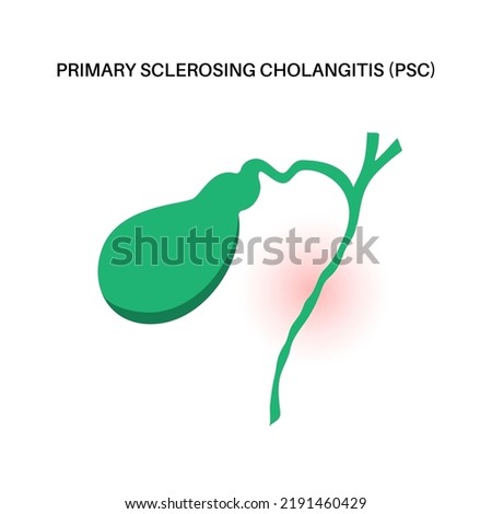 Primary sclerosing cholangitis concept. PSC Gallbladder disease.Abdomen pain in the human body. Inflammation in the digestive system. Internal organ examination in clinic. Medical vector