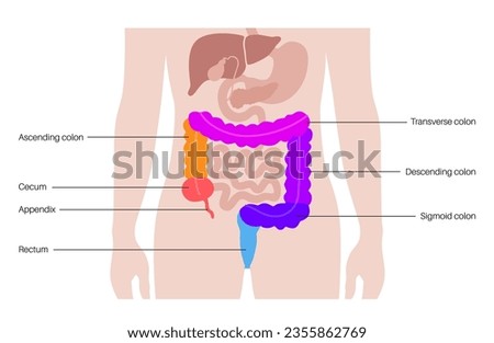 Large intestine anatomical poster. Sections of the human bowel. Digestive tract examination and treatment in gastroenterology clinic. Infographic of colon for education, isolated vector illustration