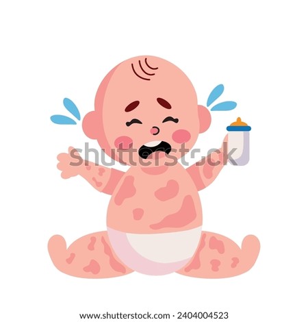 kawasaki disease baby illustration isolated