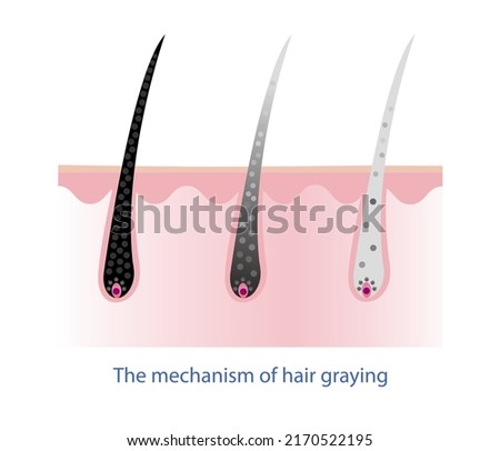 The mechanism of hair graying with scalp layer vector isolated on white background. Hair anatomy, hair structure, hair care concept illustration.