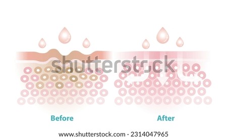 Before and after skincare reduce wrinkles vector illustration isolated on white background. Cross section of wrinkles skin and skincare absorbing to help reduce aging and damaged skin.