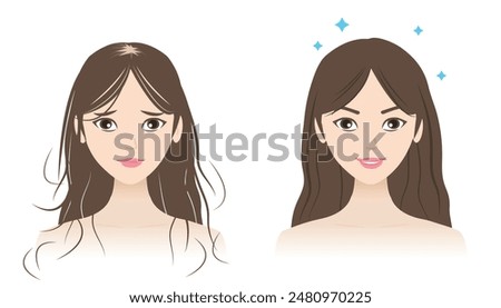 Comparison of hair loss and healthy hair vector illustration isolated on white background. The woman with reduce, decrease, thin, remove, fall hair to alopecia and strong, supple, shiny hair.