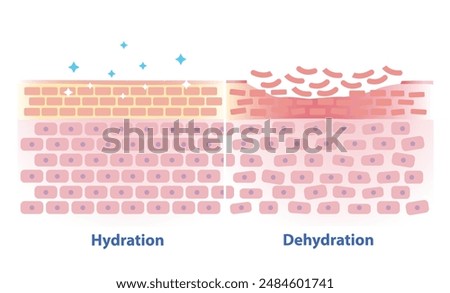 Comparison of hydration and dehydration skin vector illustration. Cross section of skin barrier layer hydration, attract, absorb water, moisture and the skin lacks water in the uppermost layer.