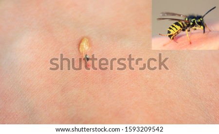 Similar – Image, Stock Photo wasps Wasps Insect Pierce