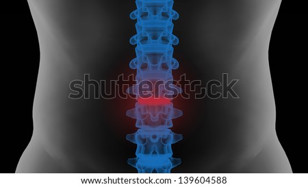Pain in Lumbar vertebrae