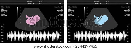 pregnancy ultrasound film genecology sonogram, medical ultra scan diagnostic control vector illustration graphic