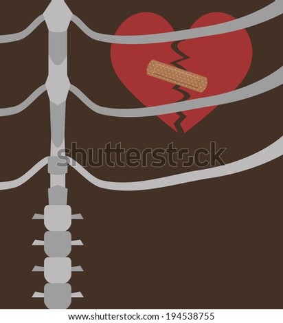 illustration of a broken heart within the chest