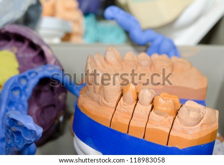 plaster model with inlay preparations, casts and utensils (working place)
