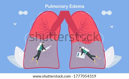 Pulmonary edema is symptom that lungs fill with fluid. Treatment and diagnostic. Body struggles to get enough oxygen until shortness of breath.