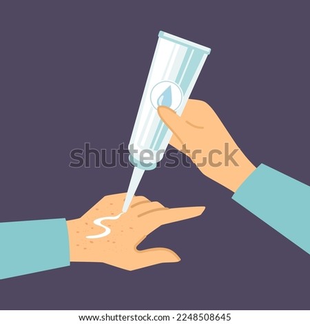 Hands of person with allergy applying cream vector illustration. Drawing of character using cream for allergic skin on purple background. Skin care, treatment, health, cosmetology, beauty concept
