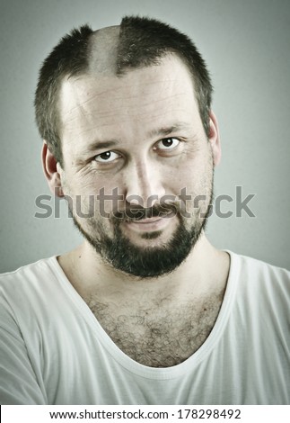 Man with funny silly half bald hair