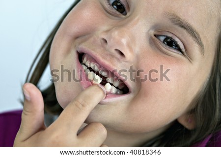 Close up of smiling young brown eyed brunette girl  with missing tooth