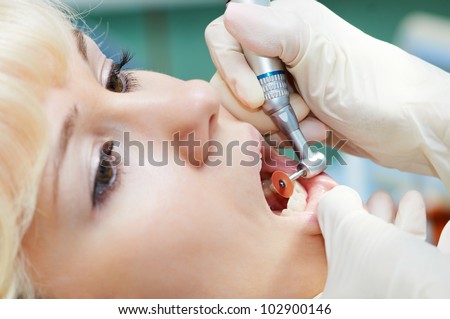 close-up medical dentist procedure of teeth polishing with cleaning from dental deposit and odontolith