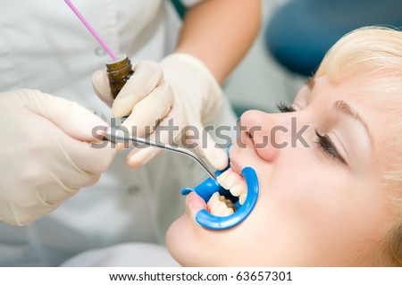 woman with open mouth during dental procedure of teeth protective lacquer covering
