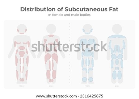 Subcutaneous fat distribution in men and women pictogram.
Vector infographic medical of fat mass areas in male and female body.
Target areas for diet treatment, liposuction, fat freezing liposculpture