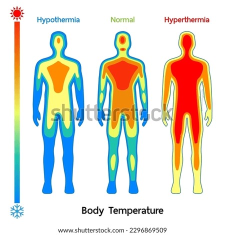 Male body Temperature model Normal, Hyperthermia and hypothermia health care infographic. Vector flat healthcare illustration. Body cooling infrared heat map isolated on white background.