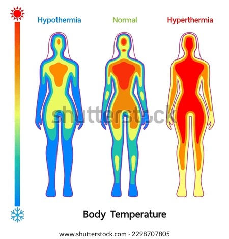 female body Temperature model Normal, Hyperthermia and hypothermia health care infographic. Vector flat healthcare illustration. Body cooling infrared heat map isolated on white background.