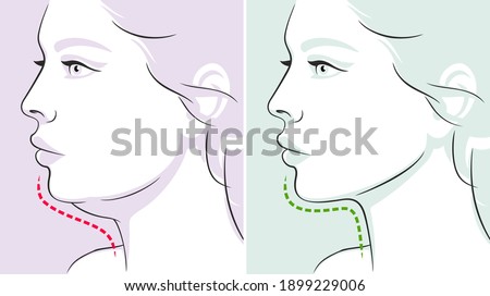 Woman profile, double chin, before-after. Woman face. Vector illustration