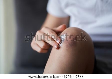 Similar – Image, Stock Photo scratch wound on female hand closeup, healthcare and medicine concept