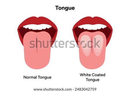 White coated tongue and normal tongue 