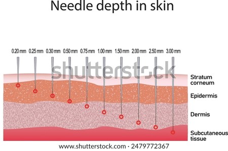 Needle depth in skin. Cosmetology procedure. Micro needling. Different size of needles.