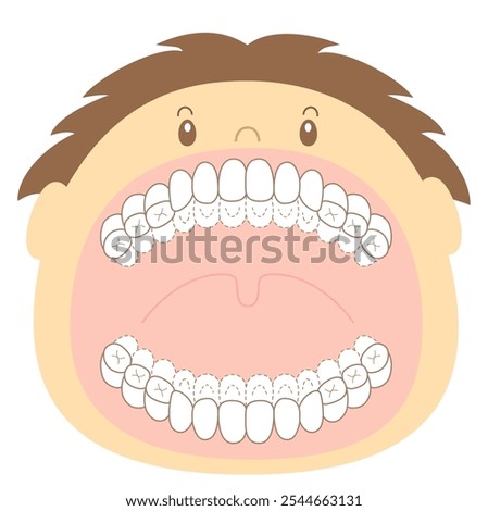 Mixed Dentition Period Plaque Check Sheet - Staining Illustration