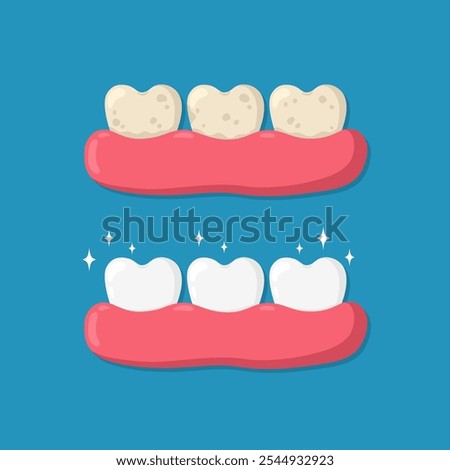 Cleaning and whitening teeth concept. Yellow teeth with plaque and white teeth in the gum. Comparison of dirty and clean teeth before and after cleaning. Dental care and oral hygiene design.