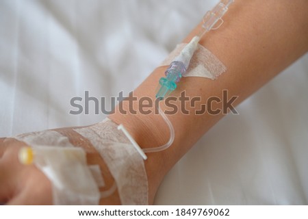 Patient's hand with Total Parenteral Nutrition (TPN) being administered into vein Foto stock © 