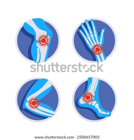 Set of joints pain icons showing symptoms of arthritis, osteoporosis, rheumatoid, gout, knee, wrist, elbow, ankle injury.