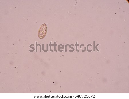 Under Microscopy Showing Trematodes (Flukes) Opisthorchis Viverrini Egg ...