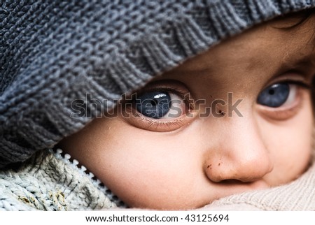 child with blue eyes and scratches