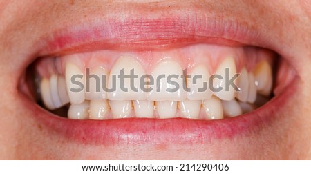 Beautiful smile and teeth from a young woman