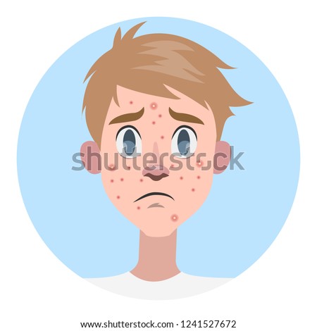 Sad man with acne on the face. Pimple on the face. Dermatology problem and puberty. Trouble with skin. Isolated flat vector illustration