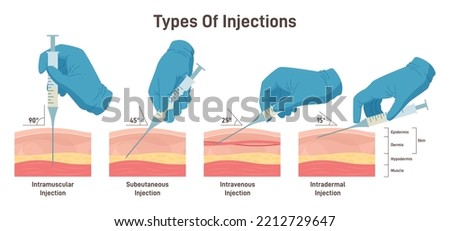 Types of injections. Guide to injecting medication into skin. Doctor holding syringes at different angles. Intramuscular, intradermal, intravenous and subcutaneous injection. Flat vector illustration