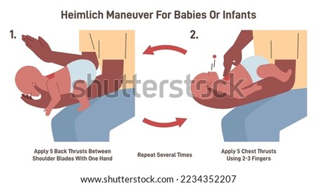 Choking first aid for an infant. Heimlich maneuver procedure to remove a foreign object from baby airways. Hands position and actions instruction. Flat vector illustration