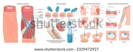 Injection sites set. Medicine injection sites on the human body. Intramuscular and intraosseous injection and venipuncture. Cubital fossa anatomy and vein structure. Flat vector illustration
