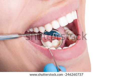 Closeup of dentist mirror reflecting lower teeth